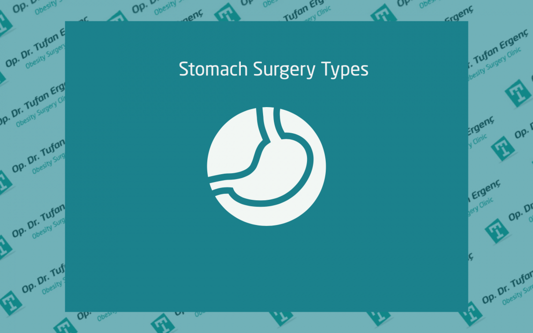 Stomach Surgery Types Op.Dr. Tufan Ergenc